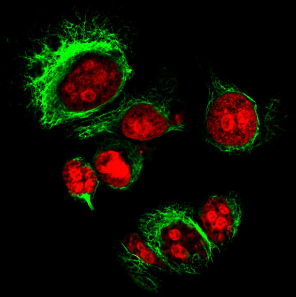 人宫颈癌传代细胞