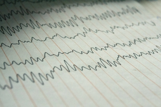 eeg