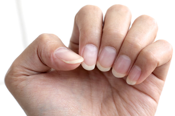 nail