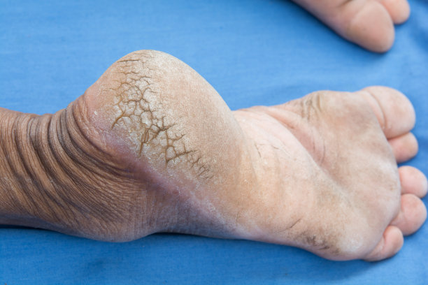 feet