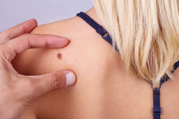 mole