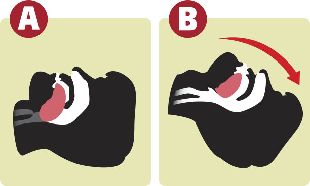 cpr
