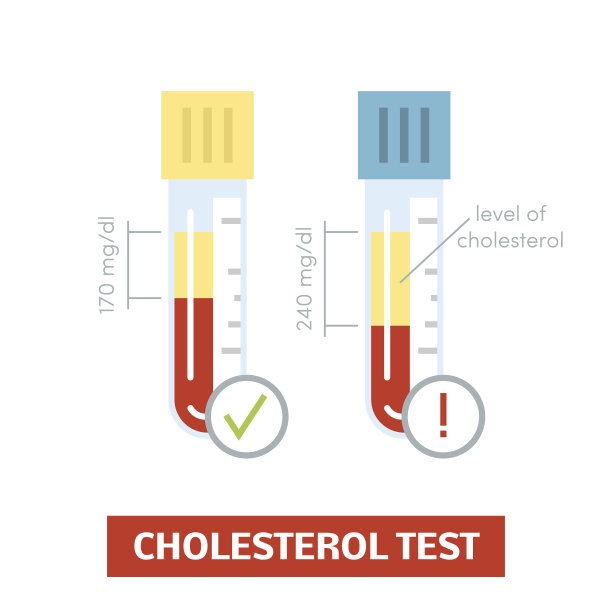 cholesterol