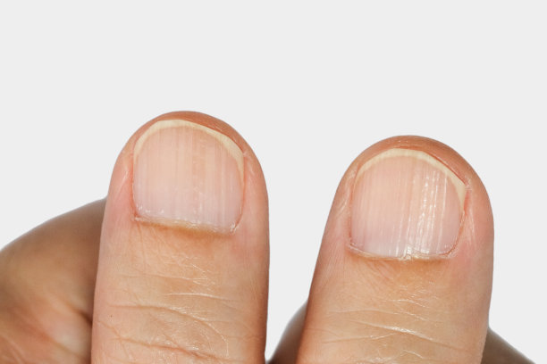 nail