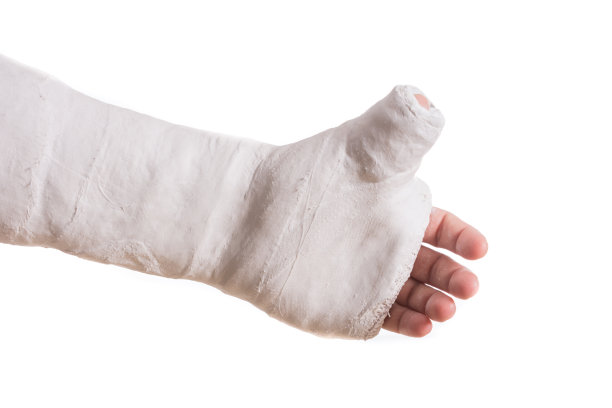 cast