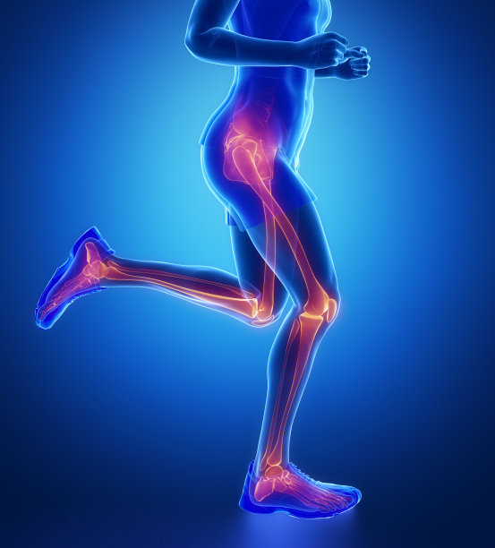 arthritis