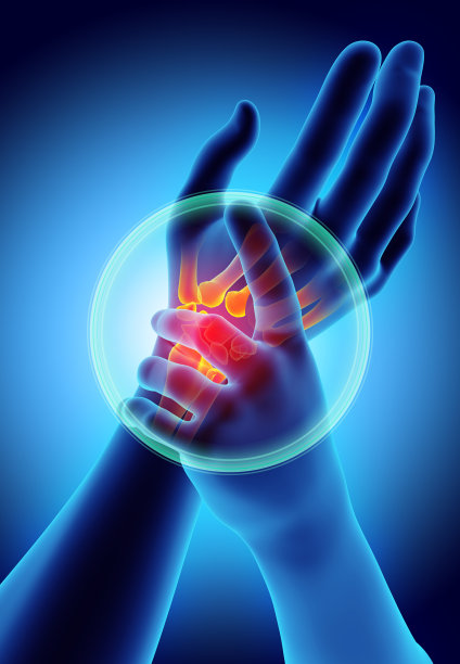 arthritis
