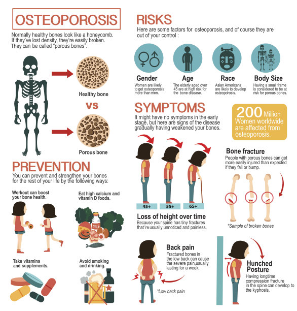 Explain T Scores For Osteoporosis