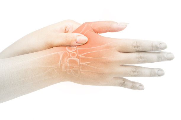 arthritis