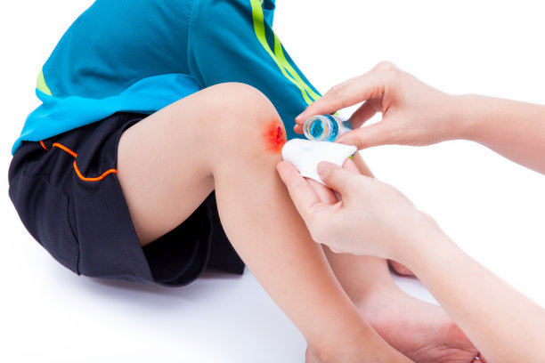 cuts