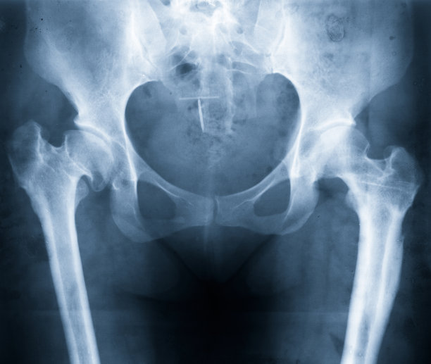 pelvis