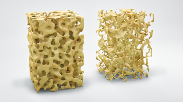bone