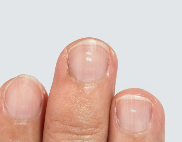 nail