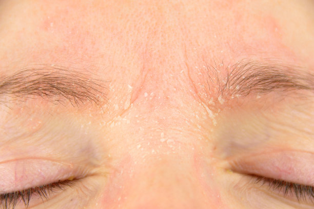 brows