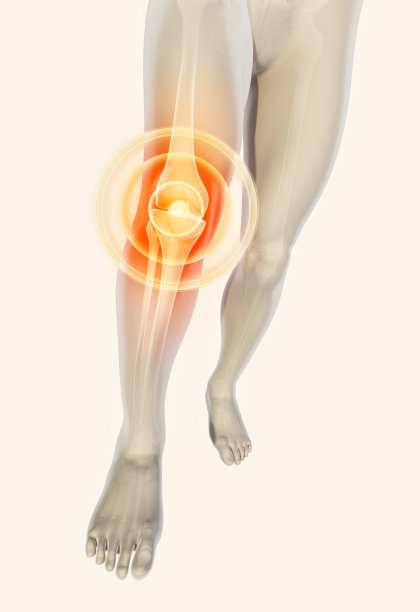 arthritis