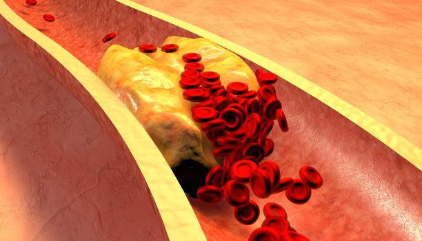 cholesterol