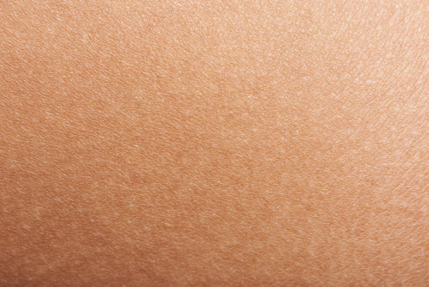 skin