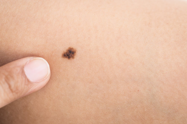 mole
