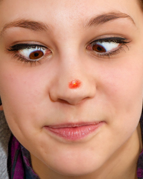 nose