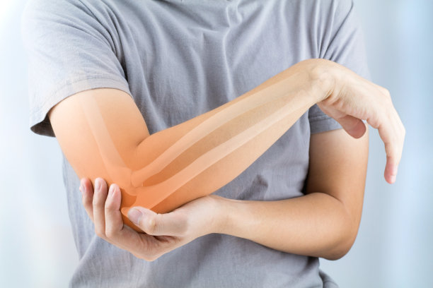 arthritis