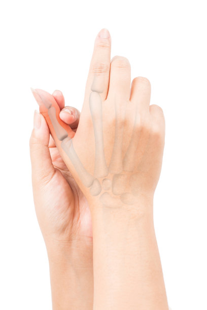 arthritis