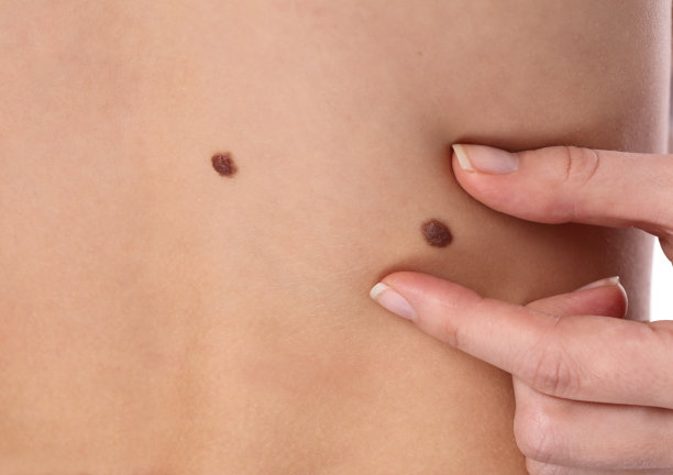 mole