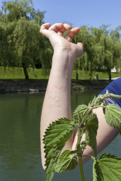 nettles