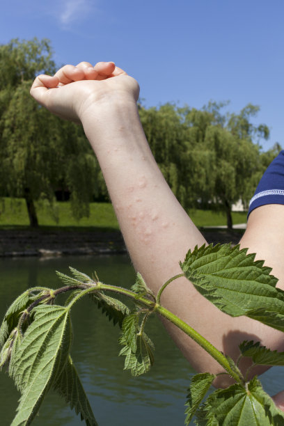 nettles