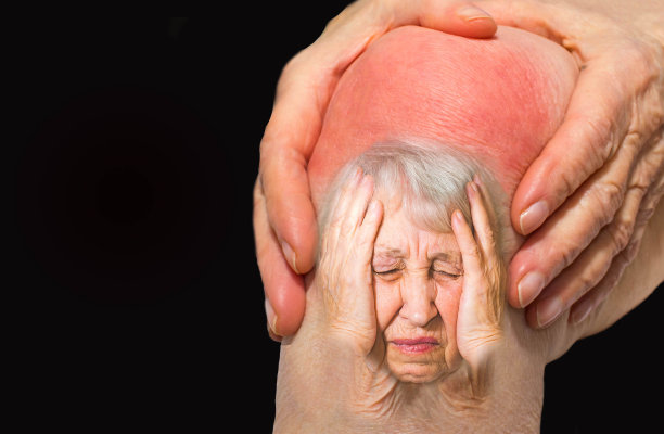 arthritis