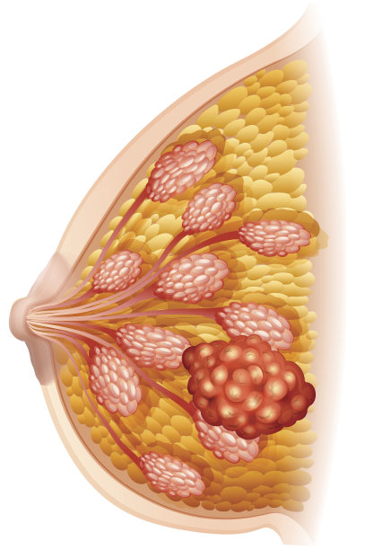 breast