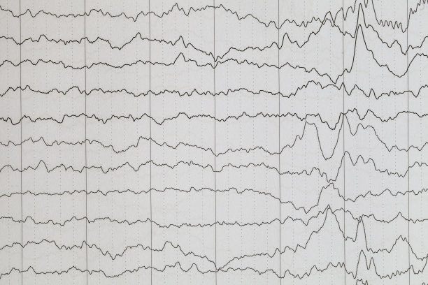 eeg