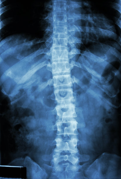 skeleton