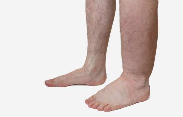 limbs