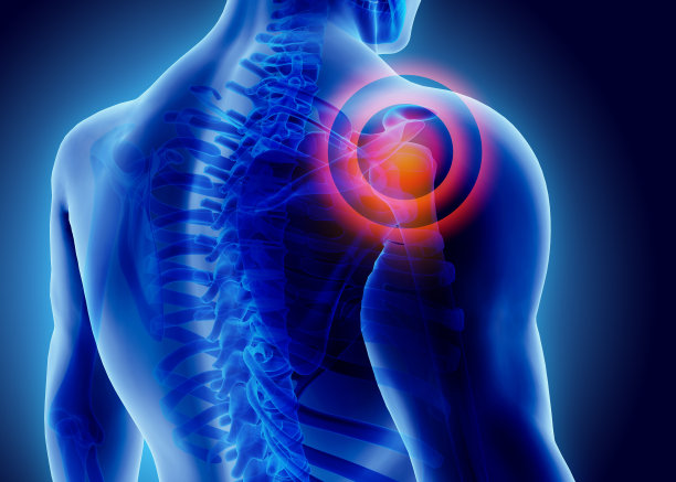 arthritis