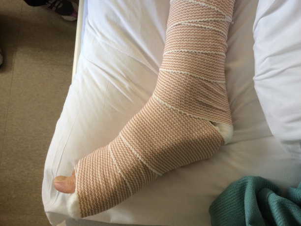 cast