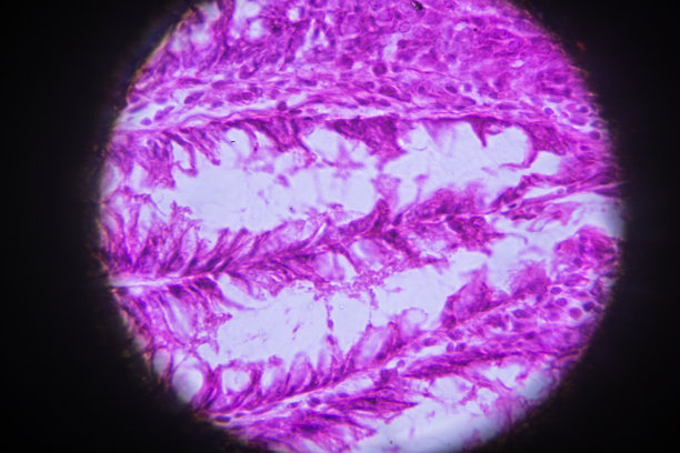髓细胞