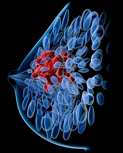 breast