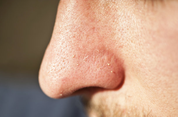 nose