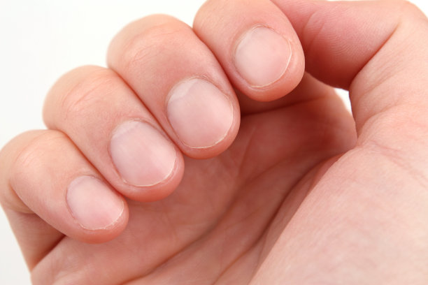 nail
