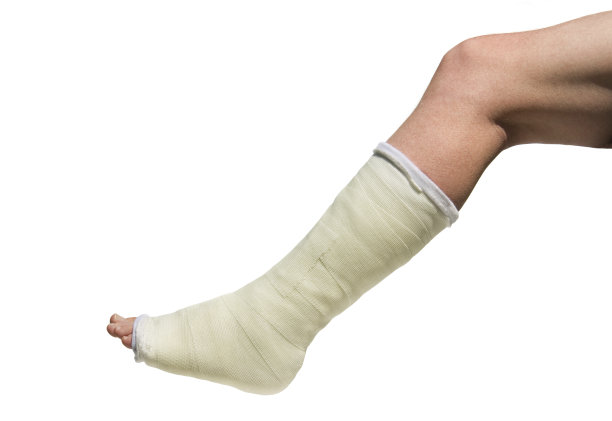 cast
