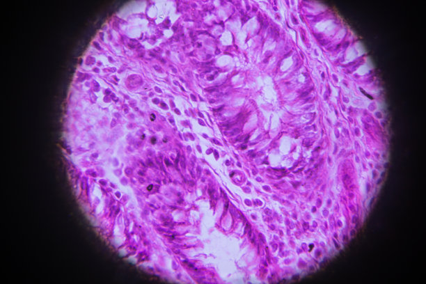 髓细胞