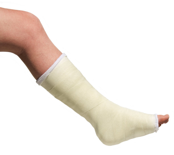 cast