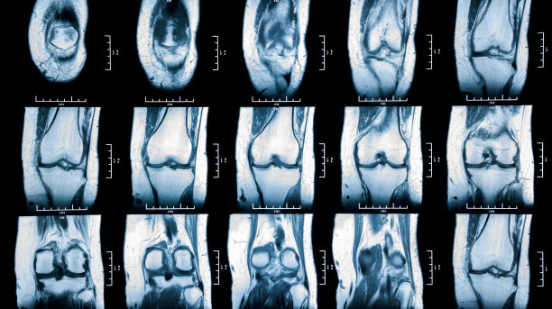 mri