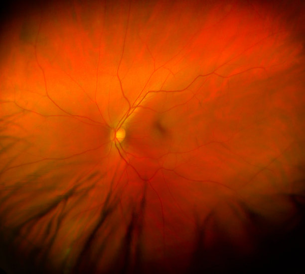 retina