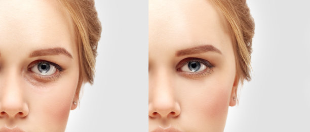eyes