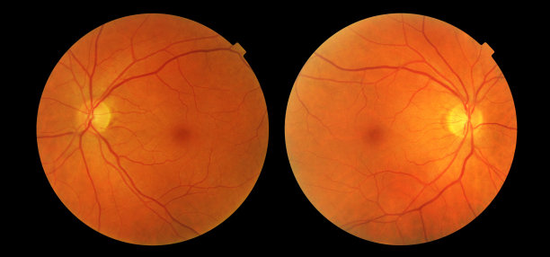 retina