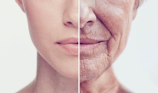wrinkles