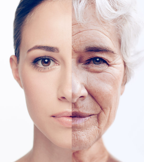 aged
