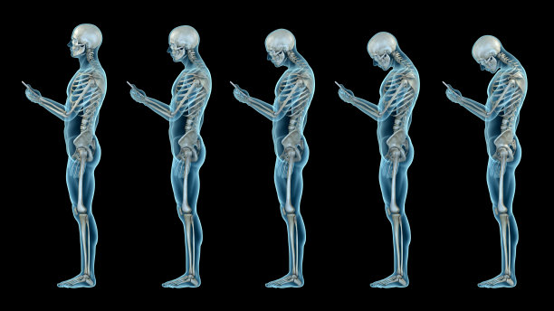 skeleton