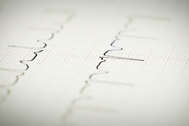 eeg